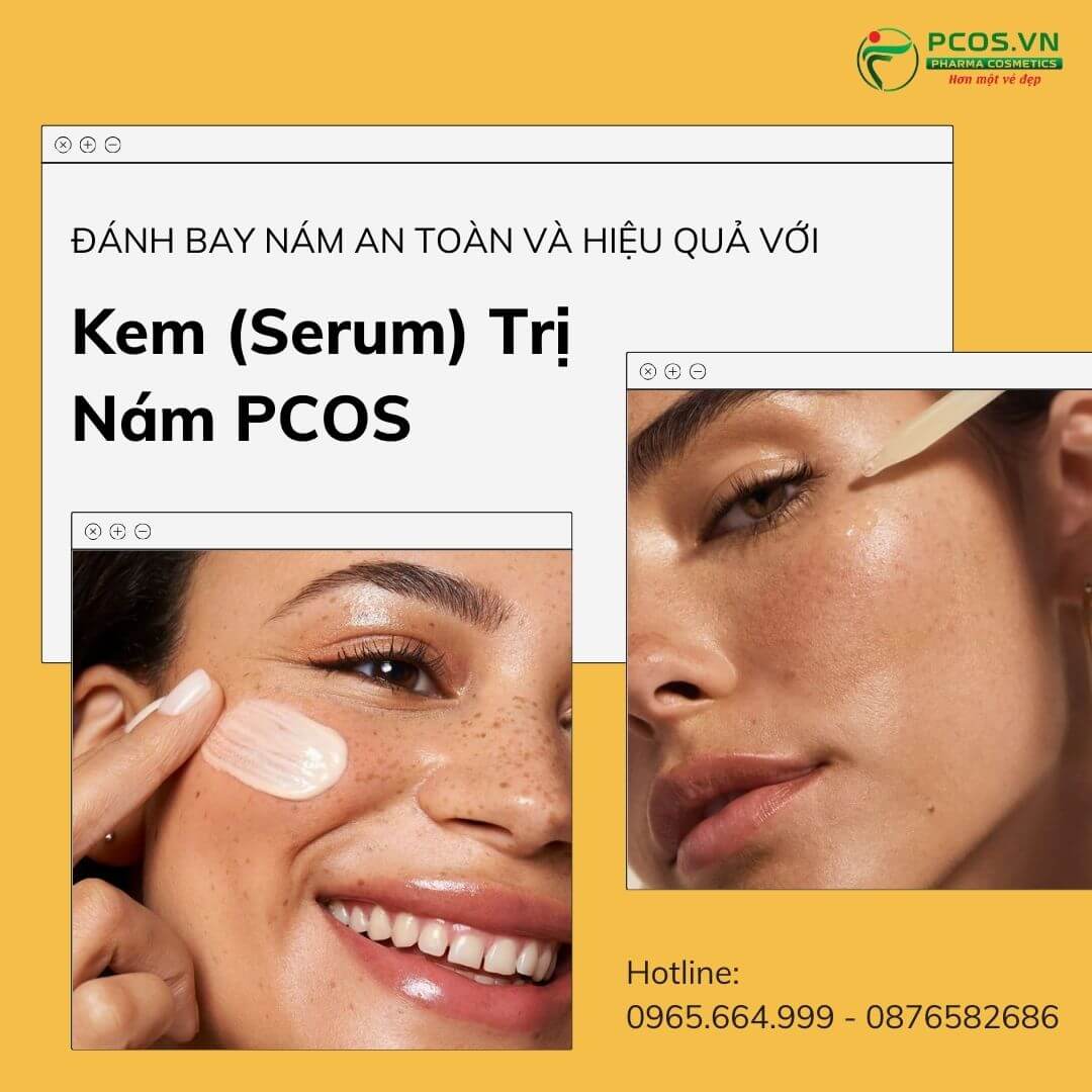 Kem trị nám PCOS đánh bay đốm nâu